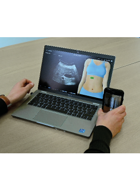 INITIATION A L'ECHOGRAPHIE